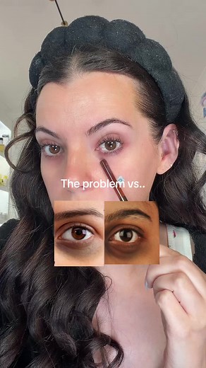 Revive Eye Serum & Patches for Brighter, Smoother Under Eyes