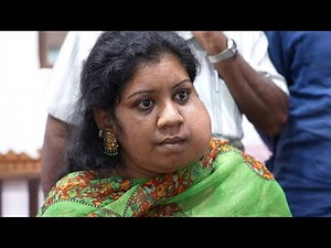 Largest Tumor on Face Pre Surgery Consultation Video