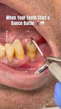 When Your Teeth Start a Dance Battle 🕺🦷