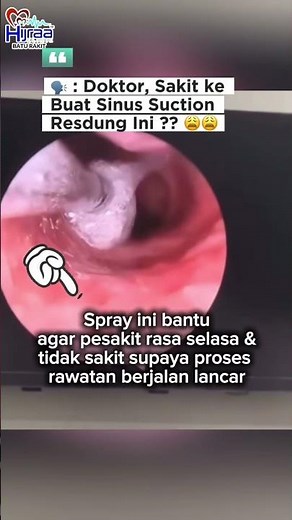 sinus suction procedure for a patient's sinuses using an endoscopic scope
