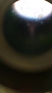 57K views · 767 reactions | Stool sample ❤️ | Lab life | Facebook