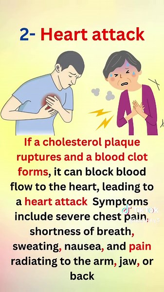 Understanding Symptoms and Dangers of High Cholesterol in the Blood