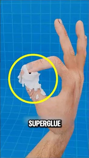 How to Safely Remove Superglue From Fingers