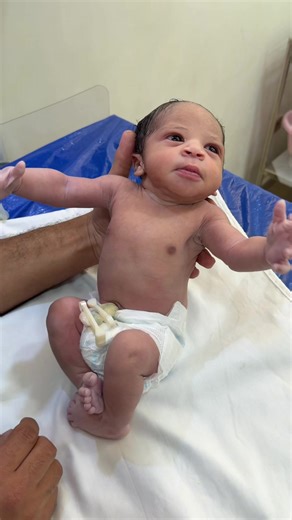 ‏Baby Moro reflex #babylove