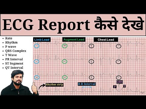 How to Read ECG | ECG Report Kaise Dekhe | ECG Report Kaise Check Kare | Normal & Abnormal