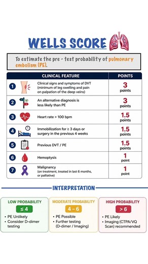 WELLS SCORE for Pulmonary Embolism (PE) 🚨🫁