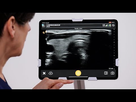 Basic Thyroid U/S Protocol