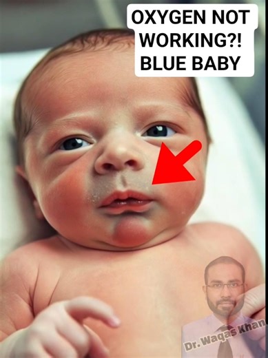 Cyanosis not improving with oxygen? Think this! #mbbs