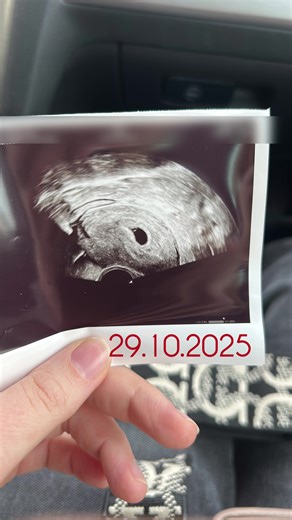 Pregnancy Journey: What to Expect as a Mom-to-Be