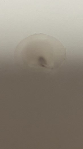 여드름 패치와 벌레 퇴치 방법