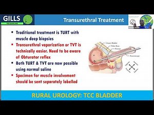 Summary on Lecture 17) Managing Transitional Cell Carcinoma in Rural Areas