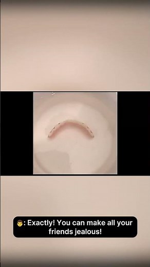 How they Look??? Instant Smile Teeth Veneers #instantsmile