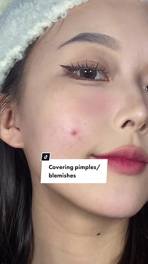 How to Cover Bumpy Pimples with Concealer Tutorial