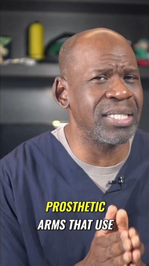 Cybernetic limbs are here! Myoelectric arms with tactile feedback are changing everything