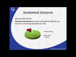 HOW TO MASTER BASIC MACULAR HOLE SURGERY