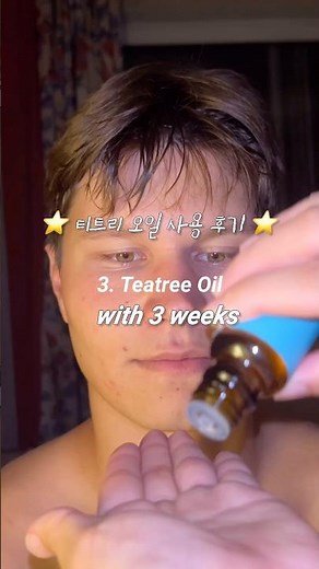 아픈 여드름 3주만에 뿌신 후기 💥 Teatree oil with 3 weeks #shorts #skincare #블랑네이처 #티트리오일