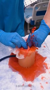 Safe trick to stop bleeding fast 🩸 | 5-Minute Crafts Play