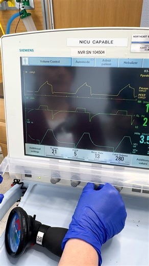 Kristine Tuttle on Instagram: "🫁 Basic Ventilator Settings ⁠ ⁠ Tidal Volume = Vt ⁠ Amount of air breathed in or out during one breath⁠ ⁠ Respiratory Rate = RR ⁠ How many breaths are taken in one minute⁠ ⁠ PEEP = Positive End-Expiratory Pressure ⁠ Pressure at the end of expiration to keep the lungs open⁠ ⁠ FiO2 = Fraction of Inspired Oxygen ⁠ How much oxygen is in the air breathed⁠ ⁠ These basic ventilator settings help you understand vent modes and alarms. It’s a great place to start when learn
