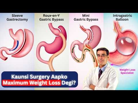Best Weight Loss Surgery 2026 | Sleeve Gastrectomy vs Gastric Bypass vs Intragastric Balloon