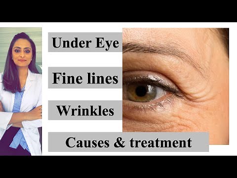 Fine lines | wrinkles| under eye| causes & treatment| Prevention | Dr. Aanchal Panth