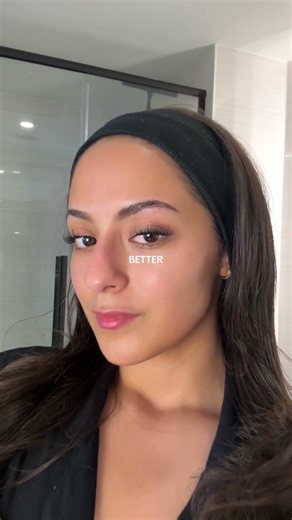 my skin got worse before it got BETTER 🥺 #glowup #skincare #koreanbeauty #skincareroutine