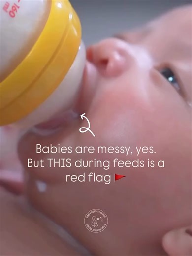 Understanding Milk Spillage During Feeding in Infants