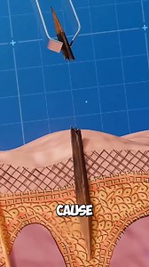 53K views · 26 reactions | How to Remove a Splinter Safely #shorts #reels #fb #viral | FactX | Facebook