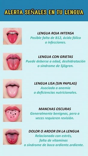 ¡LAS SEÑALES DE ALERTA EN TU LENGUA EXPLICADAS!