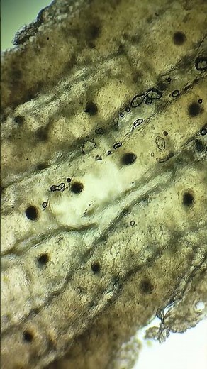 Kulit Manusia di Bawah Mikroskop | Human Skin Under Microscope 1000x Zoom #microscope #microbiology