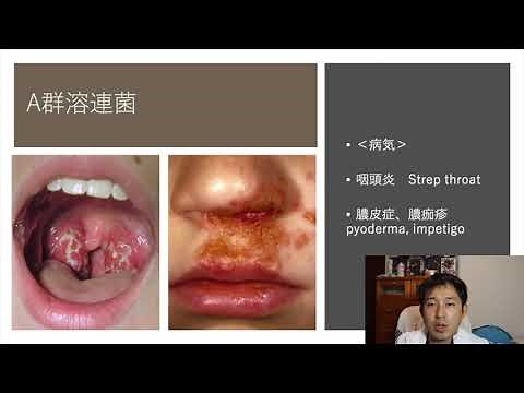 【だれでもわかる細菌学 第9回】溶連菌(Group A Streptococus)