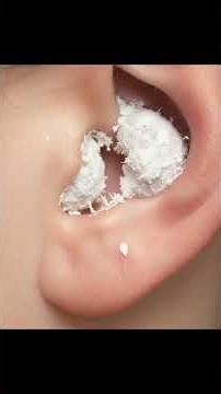 what your ear wax color says about your health