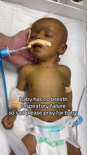 Baby's Respiratory Failure: A Serious Situation