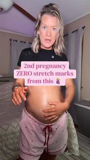 Happy Baby on Instagram: "Pregnant mamas do not sleep on the belly care! You get the serum to moisturize and the balm to really hydrate and lock it all in. I swear by this after having zero stretch marks my first pregnancy #stretchmarks #pregnancy"