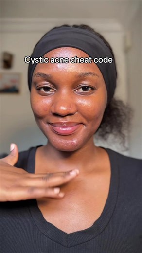 Calming Cystic Acne: Products That Work