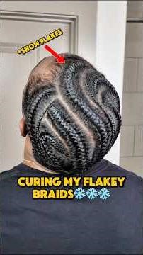 Curing my flakey braids❄️