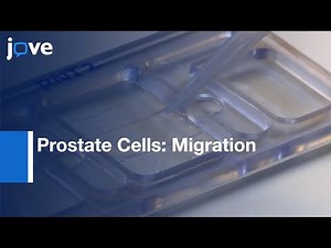 Directional Migration Of Prostate Cells:Utilizing Custom-designed Galvanotaxis Chambers