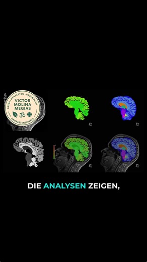 12 Tage nichts essen – und du bist fitter denn je? „Was wirklich im Körper passiert – neue Studien belegen es“ 🔗⬇️⬇️⬇️ https://cutt.ly/Heilfasten_Ratgeber 💥 Kommentiere: RATGEBER, und ich sende dir den kostenlosen Heilfasten-Ratgeber: ✔️ 6 tiefgreifende Wirkungen ✔️ wissenschaftlich fundiert ✔️ Anleitung & Tipps für deinen Start ⚡ Viele glauben: „Ohne Essen keine Energie!“ Doch die Fakten zeigen etwas anderes. Neue Studien beweisen: 🔹 Keine Leistungseinbußen bei 12 Tagen Fasten 🔹 Muskeln ble
