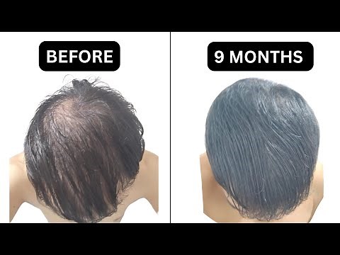 Diffuse Thinning - What to do today