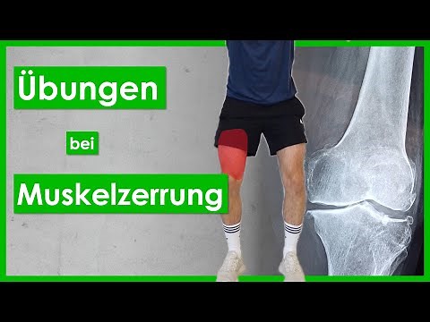 Thigh strain🦵Tear of the front of the thigh⎮Quadriceps injury⎮Rehab