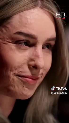Stephanie Browitt: Unmasked Survivor of Volcanic Eruption