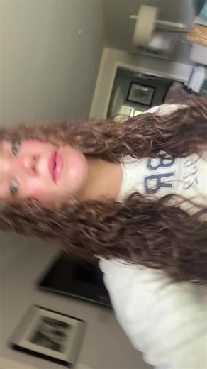 #frecklesonyourface 🙌