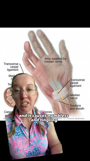 101K views · 1.8K reactions | Case study 82 answer - Carpal Tunnel...