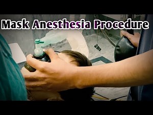 Mask anesthesia Procedure | Small Baby Boy Going Under General Anesthesia | Anesthetic Waseem