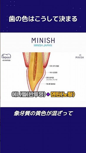 How the color of teeth is determined