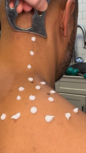 14K views · 524 reactions |  Instrument Assisted Soft Tissue Mobilization (IASTM) helps break up scar tissue and fascial restrictions using specially designed tools. This technique promotes better circulation, restores mobility, and speeds up recovery from overuse or injury. #IASTM #SoftTissueTherapy #ChicagoChiropractic Chiropractordrkyleross | Chicago Sports Chiropractors | Facebook