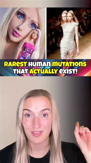 2.4K views · 16 reactions | RARE Human MUTATIONS That ACTUALLY Exist! #Reels | Inet Technology Central | Facebook