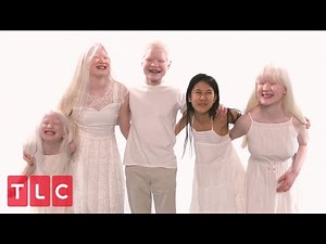 The Grabowskis' Unique Adoption Story (Part 2) | Born With Albinism