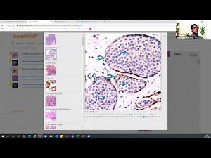 Introducción a ExpertPath e Immunoquery: ayuda digital al diagnóstico en Anatomía Patológica