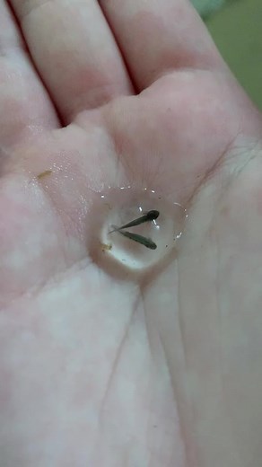 Meet the Twin Baby Axolotls