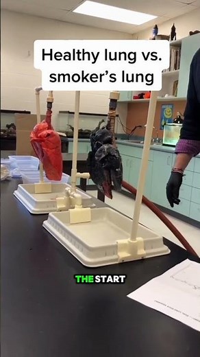Doctors Compare a Healthy Lung vs Smoker’s Lung… The Difference Is Shocking